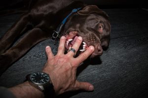 dog biting fingers